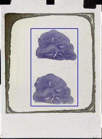 Media type: image; Special Collections 3043   shows specimen_part histological serial section;